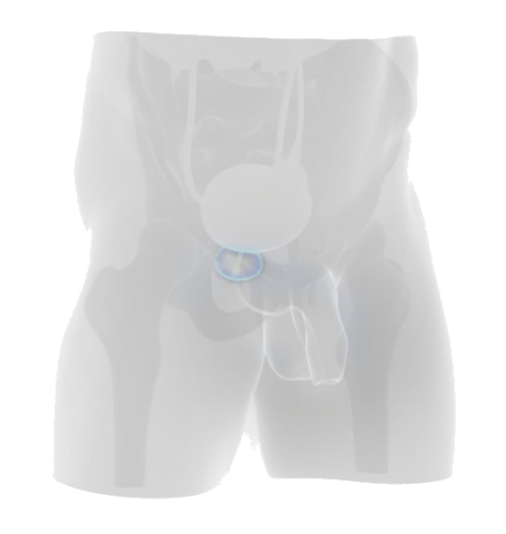 prostate mri pi rads